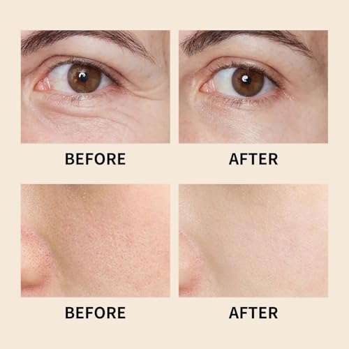 Frankincense Resin Oil for Face, Frankincense Oil for Skin, Frankincense Resin Infused Organic Black Seed, Castor & Jojoba Oil for Face, Facial Moisturizing Anti-Aging Serum (1PC, 1)