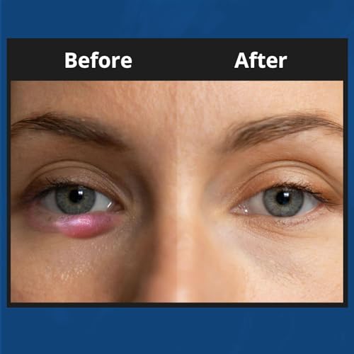NOVEHA XStye Eyelid Foaming Cleanser - Fast Stye Eye Relief - Formula With Tea Tree Oil - Daily Eyelid and Eyelash Wash For Stye Eyes, Eyelash, & Skin Dryness (3.38 fl oz) - 3PK - 100mL
