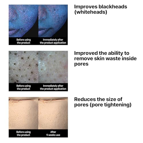 SOME BY MI Lacto Soy Sebum & Blackhead Cleansing Oil ? 6.76oz, 200ml ? Korean Vegan Makeup-Removing Oil Cleanser with Soybean Extract & Serine ? Deep Cleansing for Blackheads & Pore ? Korean Skin Care