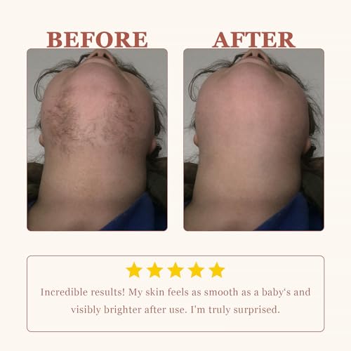 Facial Hair Removal Cream Kit for Women Face Sensitive Skin with Calm Cream, Painless Facial Depilatory Cream for Face Chin Lip Fuzz, 4 Mins Hair Remover At Home, 2.37 fl.oz w/Spatula