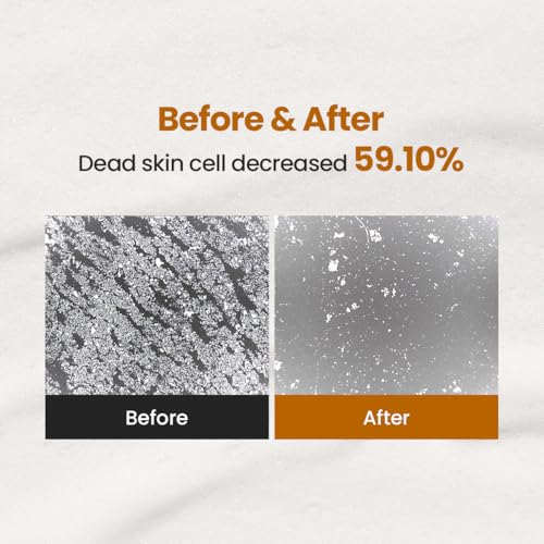 Enzyme Cleansing Powder ? 15g (0.53 oz) ? Purifies Pores, Removes Blackheads & Whiteheads, With Papain Enzyme for Smooth & Clear Skin | Low pH, Non-Irritating, For Sensitive Skin