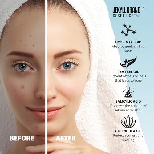 Pimple Patch for Cheeks (12 counts) COSMETICS¢â | Medical Grade Hydrocolloid | Acne Patch for Covering Zits and Blemish | Cheeks Patches for Acne | **Dermatologist Approve**