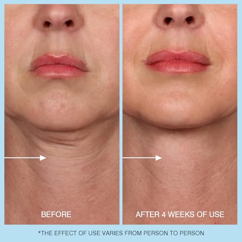 Retinol Neck Cream - Hyaluronic Acid & Caffeine Enriched Neck Firming Cream | Anti-Aging 3-in-1 Moisturizing Cream to Minimize Fine Lines, Dullness & Sagging Skin for Neck, Chest & Face (50ml/1.7oz)