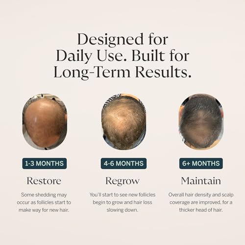Happy Head Dermaroller for Scalp, Beard and Face ? 0.25mm Microneedling Tool to Help Scalp Stimulation, Refine ? Skin Care and Grooming for Men and Women