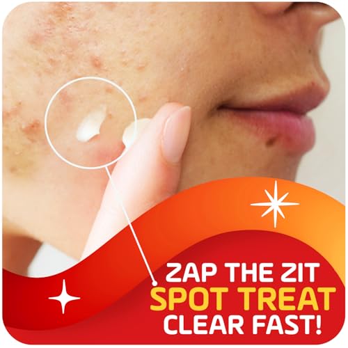 Asepxia 2% Salicylic Acid Acne Spot Treatment Cream | Drying Formula Targets Acne, Clears & Prevents Blemishes, Reduces Redness, Penetrates Pores, Pimple Cream, 1 Oz, 3-Pack