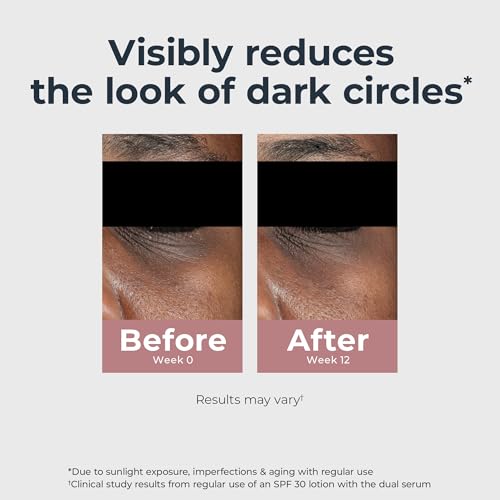 Eucerin Radiant Tone Eye Cream Dark Circle Corrector, Eye Brightening Cream with Thiamidol and Hyaluronic Acid, Helps Reduce the Look of Eye Puffiness, 0.5 Oz Tube