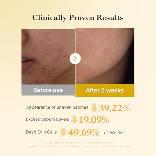 Mighty Patch Nose Patch and Pore Release from Hero Cosmetics