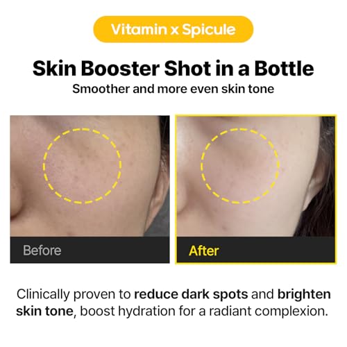 Cell Fusion C Toning C Vita Shot Ampoule, Brightening Vitamin C Serum for Face with Spicules, Zero Dark Spots & Glow Serum for Sensitive Skin, 20g / 0.7 oz.