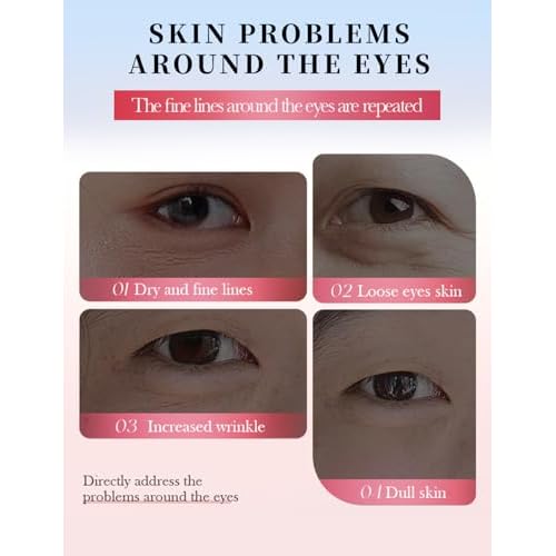 Under Eye Patches for Dark Circles - 80 PCS Eye Mask with Niacinamide, Collagen & Natural Extracts to Reduce Bags, Wrinkles, Fine Lines & Puffiness for Firmer, Elastic, Glowing Skin.