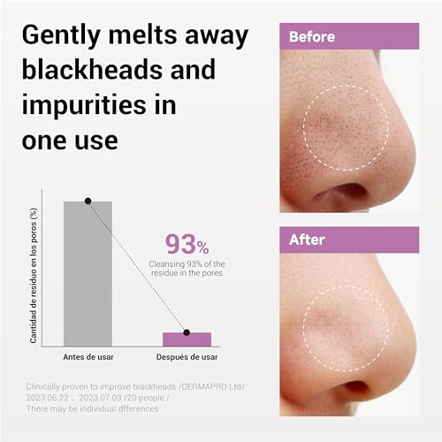 HEIMISH All Clean Balm 4.0fl.oz/120ml - Cleansing Balm, Waterproof Makeup Remover, Face Cleanser, Oil Based Cleanser, Korean Skincare with Natural Aroma Oil, Vegan, For All Skin Types
