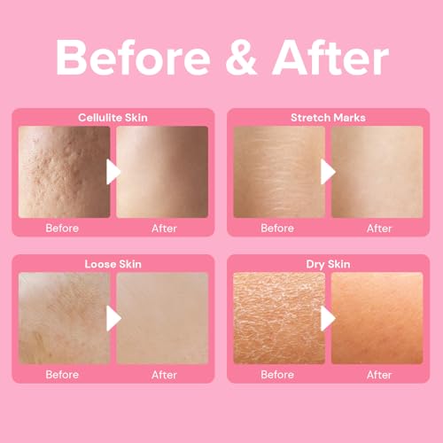 Enaskin Naturals Anti-Cellulite Cream: Firming Solution for Booty, Legs & Belly - Skin Tightening & Lifting Body Mask for Toning, Lift & Firm Moisturizing Bum Bum Care