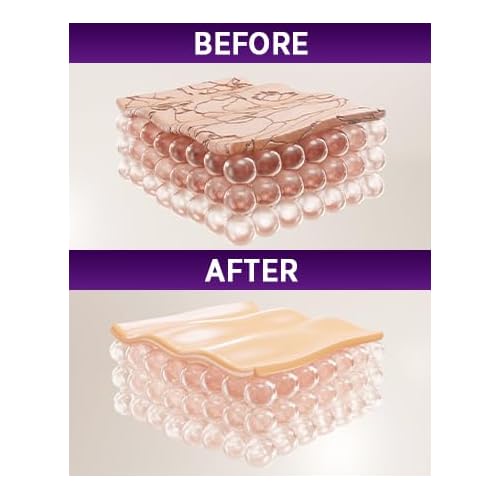Stretch Mark Cream Prevention for Pregnancy - Maternity Cream for Stretch Marks Removal | Nourishing Formula ? Prevents Stretch Marks & Improves Elasticity - 4 oz (120g) (2 Pack)