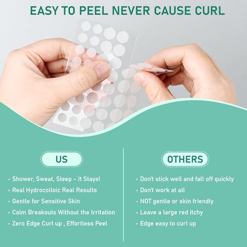 Large Hydrocolloid Pimple Patches for Face, Variety Pack 5 Sizes 196 Count, XL Invisible Acne Spot Dots Stickers for Chin, Nose, Back, Forehead Zits, Blemishes & Breakouts, Tea Tree Oil Salicylic Acid