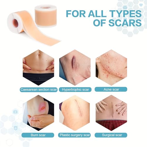 Medical Grade Silicone Scar Sheets 1.6"x 157" Roll-4M Keloid Scars Removal C-Section Scar Strip Painless Treatment Resuable Tummy Tuck Tape Professional for Surgical Incision,Acne,Burn Scar