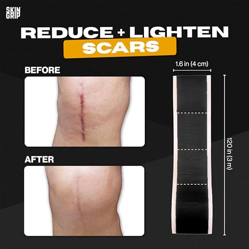 Skin Grip Medical Grade Silicone Scar Tape 1.6"x120" Roll - Increased Strength & Reduced Irritation - Silicone Scar Sheets For Face, Surgical Scars, C-Section, Keloid Treatment, Tummy Tuck, Burn, Acne