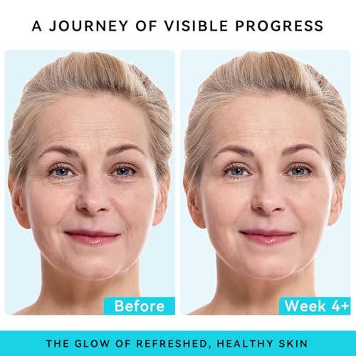 Double Size (4OZ) Hyaluronic Acid Serum for Face 3.5%, Hyaluronic Acid Moisturizer, Hydrating Serum for Face, Moisturizing Hyaluronic Acid Serum with Seaweed and Chamomile, Glow Face Serum for Women