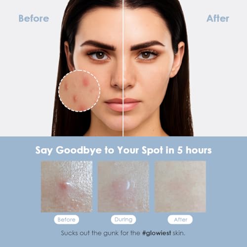 glowiest ASAP Active Spot Alleviating Patch [Bedtime] 52 Patches 8mm (16ea), 10mm (20ea) & 12mm (16ea) | Premium Hydrocolloid Dressing | Simple & Easy Active Treatment