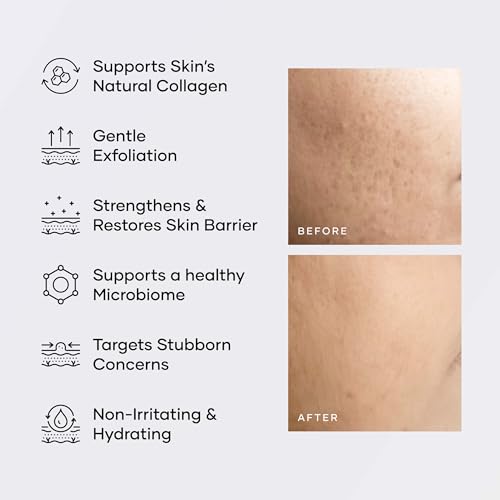 Cureskin Glyco Clear Cream | Repair Cream with Sustained Release | Glycolic Acid, Amino Acids and Prebiotics