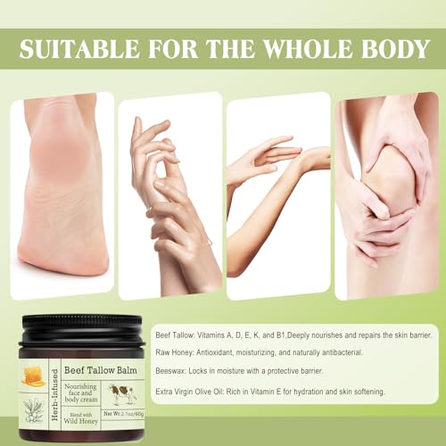After Sun Lotion with Aloe Vera - Ultra Cooling Aloe Vera for Sunburn Hydration with Cocoa Butter & Rosehip Oil - Hydrating Aloe Lotion After Sun Moisturizer for Dry Skin with Hyaluronic Acid