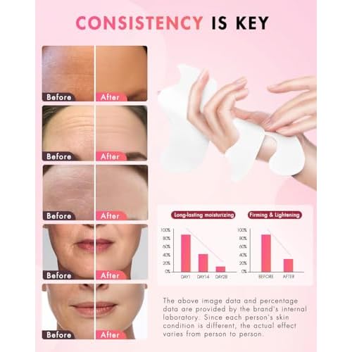 Forehead Wrinkle Patches & Smile Line Patches, Overnight Facial Wrinkle Treatment with Hyaluronic Acid, Aloe, Collagen & Vitamin E to Lift Smile Lines for Women 72pcs