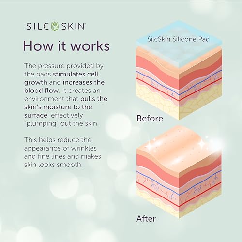 Silc Skin Complete Chest And Neck Care Set With Decollette And Collette Pads, Reusable Medical Grade Silicone For Sleep Lines, Holiday Anti Wrinkle Gift Set For Her, 30 Day Supply