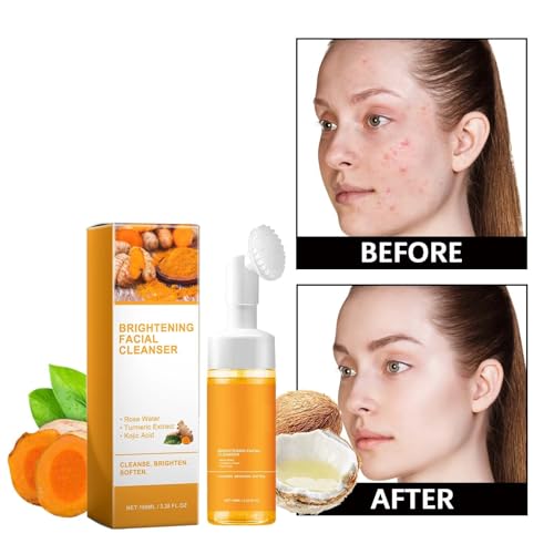 LANBENA Vitamin C Under Eye Patches for Dark Circles and Puffy Eyes, Cooling Eye Masks for Eye Bags, Fine Lines & Wrinkles Reduce, Anti-Aging, with Niacinamide Hydra-Gel Collagen-30 Pairs