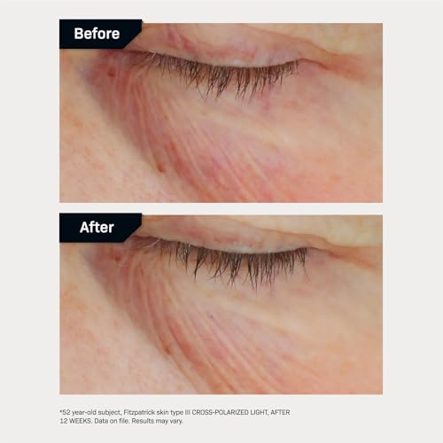 Revision Skincare C+ Brightening Eye Complex¢â with Vitamin C and Antioxidants, Eye Cream for Dark Circles and Under Eye Puffiness