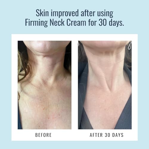 Foundation Skincare Firming Neck Cream - Firms, Strengthens, & Hydrates Crepey Skin for a More Youthful-Looking Neck & D?colletage - with Peptides & Natural Moisturizing Agents - 2 Oz