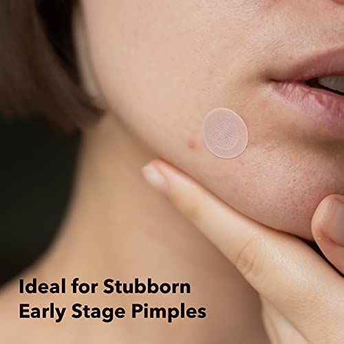 AVARELLE Multi-dart Spot Tech Microneedle Patch by | Acne Patches for Early-stage Blemish, Stubborn Deep Rooted Pimples | Facial Skin Acne Dots | Cruelty Free Certified, Carbonfree(18 CT)