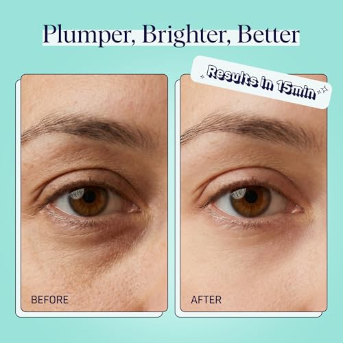 SpaLife Cooling Cucumber Eye Pads | Korean Dark Circles & Puffy Eyes Treatment | Nourishing Cucumber Eye Pads | Eye Mask for Puffy Eyes Daily Depuffing Eye Patches | 48 Count