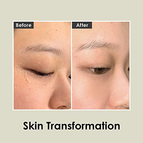 MEDI-PEEL Herbal Peel Tox 4.23 fl oz / 120g | Peeling Facial Soothing Cleanser, Exfoliating Cleanser | Wash Off Cream Mask | Vegan, Korean Skincare, For All Skin Types