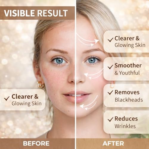 LUXUZ Oligopeptide Facial Serum for Acne Removal, Dark Spot Corrector & Skin Repair ? Post Acne Marks Fading, Glass Skin Brightening Serum with Peptides & Niacinamide ? Non-Comedogenic, 1.0 fl oz