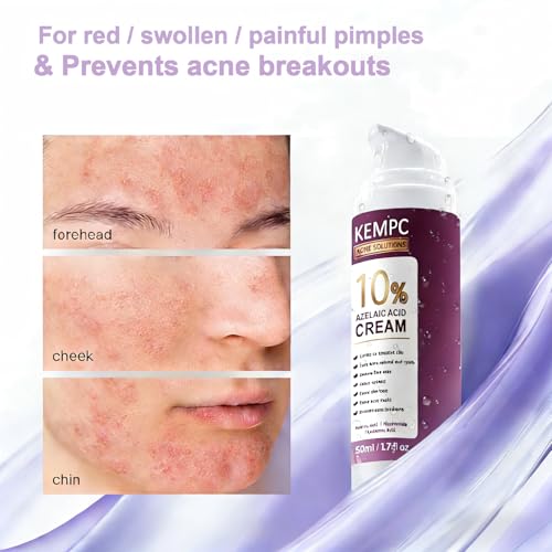 Nip + Fab Glycolic Fix Night Pads Extreme (60 Count) ? 5% Glycolic Acid Exfoliating Face Pads with Salicylic Acid ? Resurfacing AHA BHA Chemical Peel for Blemishes & Texture