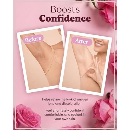 Intimate Skin Brightening Cream ? Tone-Balancing Formula with Kojic Acid, Arbutin & Niacinamide ? Gentle for External Intimate Areas, Underarms & Inner Thighs ? 2oz