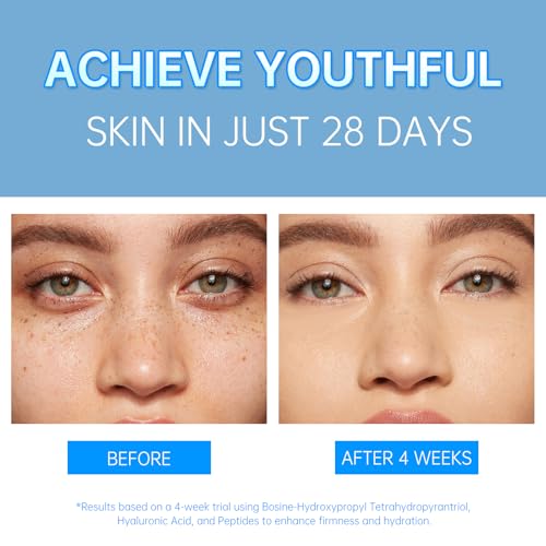 VGO Pro-Xylane Active Cream - Plumping & Firming, Daily Face Repair Moisturizer Hydrating for All Skin Types 30g / 1.02oz