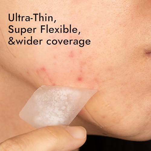 Epielle Over-Zit XL Acne Clear Patches | Ultimate Hydrocolloid Solution | 14 Extra-Large Pimple and Blemish Patches