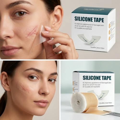 Silicone Scar Sheets for Surgical Scars 120" *1.5" Roll Medical-Grade Silicone Technology?Advanced silicone 1 Pack