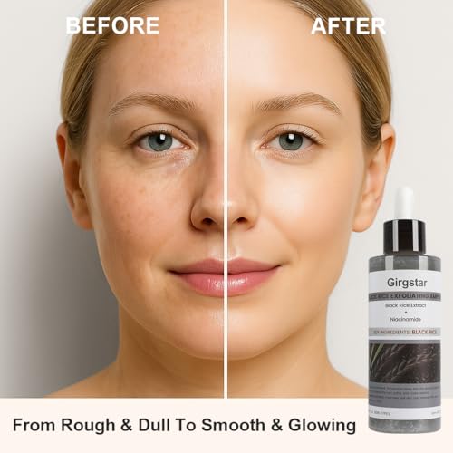 Black Rice Peeling Ampoule 80ml - Peel Shot Glow Exfoliating Face Peel | Gentle Dead Skin Cell Remover for Brighter Smoother Complexion | All Skin Types Rice Extract Skincare