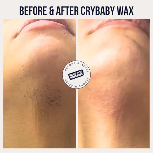 Crybaby Wax I¡¯m Sensitive Meltdown Vegan Hard Wax 6.5oz, Coconut-Infused Stripless Wax for Sensitive Skin, PCOS Facial Hair, Face, Bikini, Underarms & Body (2.2 Pounds)