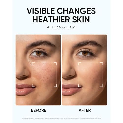Face Moisturizer with 5X Ceramides, Hydrating Moisture Barrier Repair Cream for Sensitive/Oil Skin Types, Hyaluronic Acid & Centella, Daily Facial Moisturizer, Non-Comedogenic 30g/1 fl.oz