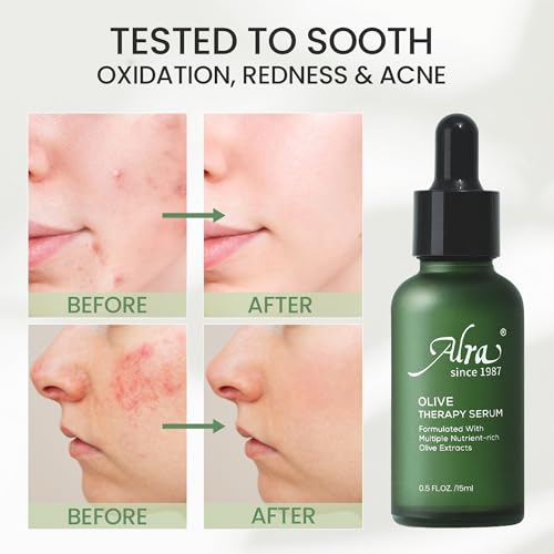 Alra Olive Therapy Serum for Face, Face Serum with 22% Olive Extracts, Reduces Redness & Acne, Rapidly Clear Breakout for Teens Adults, fit Oily & Acne-Prone Skin, 1 fl oz/30ml