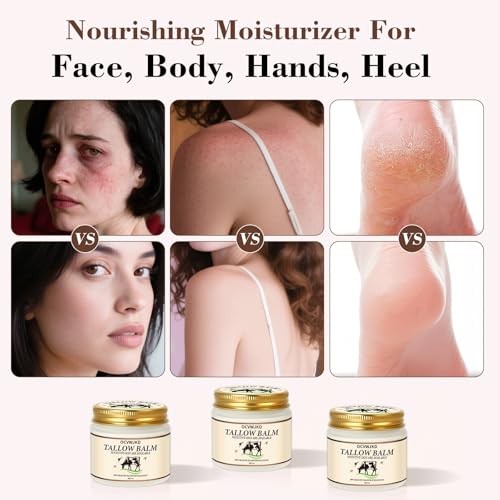 Beef Tallow & Honey Balm, Beef Tallow for Skin, 3 Packs All-Natural Moisturizer Hydrates and Nourishes the Skin, Grass-Fed Beef Tallow & Raw Wild Honey Blend, Body & Face Moisturizer (6 Oz)