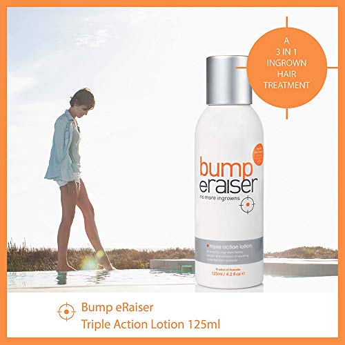 Triple Action Soothing Lotion for Ingrown Hair Treatment, Razor Bumps and Razor Burns