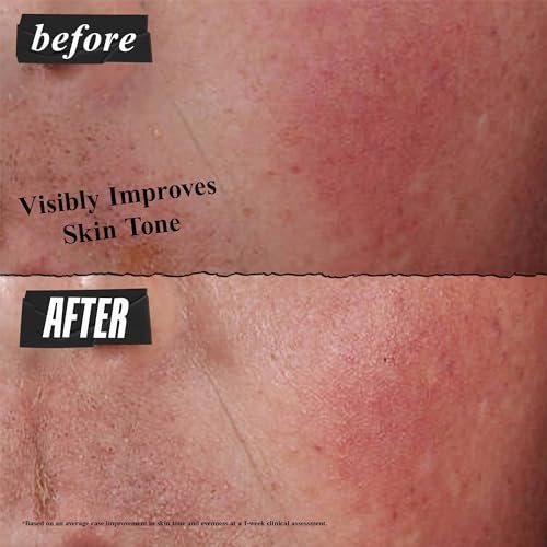 Kiehl's Ultra Facial Advanced Repair Barrier Cream, Intensive Treatment Relieves Dry + Sensitive Skin, Rapidly Reduces Redness and Soothes, Fast-Absorbing Breathable Formula, Paraben-Free - 1.7 fl oz