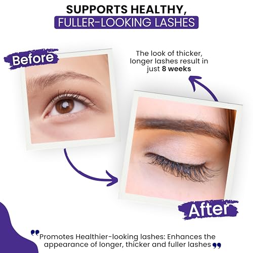 RapidLash Eyelash Enhancing Serum with HEXATEIN 1 Complex ? Lash Serum for Eyelashes Conditioning & Hydrating ? Longer-Looking, Fuller and Thicker Appearing Lashes ? 3 mL / 0.1 fl oz