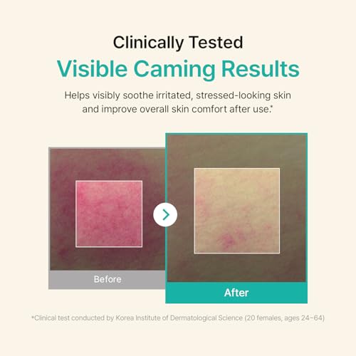 ACWELL Licorice pH Balancing Extreme Moisture Cream ? Optimal Skin Repair for Sensitive Skin, Hydrating Face Cream with Panthenol and Ceramide Capsules, 1.86 oz.