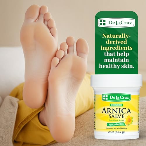 De La Cruz Arnica Salve - Foot Cream for Dry Cracked Heels and Feet - Moisturizing Hand Salve for Dried Hands - 24 Hour Moisture Foot Cream for Dry Cracked Feet and Rough Skin - (2 Ounces)