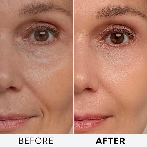Retinol Cream for Face with Collagen Peptides - Anti Aging Wrinkle Cream for Women and Men - Day-Night Facial Moisturizer with Hyaluronic Acid - Tightening and Skin Firming - Neck & D?collet?