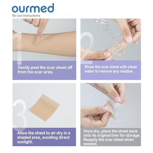 Silicone Scar Removal Tape (1.6" x 120" Roll - 3M), Medical Grade Silicone Scar Removal Sheets, Hypoallergenic for New and Old Scars ? Surgery, Burns, Acne, Keloids, Stretch Marks, C-Section