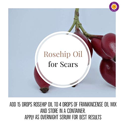 d?ve herbes Rosehip Oil (Rosa rubiginosa) | Cold Pressed | Pure | Natural | Undiluted | For Diluting Essential oils | For Skin & Massage | Non-Sticky| Lightweight| Men & Women | 10ml (0.33 oz)